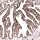 Immunohistochemical staining of human seminal vesicle shows moderate nuclear positivity in a subset of glandular cells.