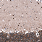 Immunohistochemical staining of human cerebellum shows strong nuclear positivity in cells in molecular layer.