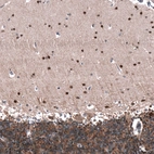 Immunohistochemical staining of human cerebellum shows strong nuclear positivity in cells in molecular layer.