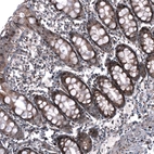 Immunohistochemical staining of human colon shows moderate to strong cytoplasmic and nuclear positivity in glandular cells.