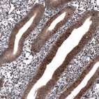 Immunohistochemical staining of human endometrium shows strong cytoplasmic and nuclear positivity in glandular cells.