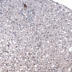 Anti-ID1 Antibody