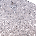 Immunohistochemical staining of human liver shows very weak nuclear positivity in hepatocytes.