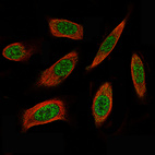 Anti-ID1 Antibody