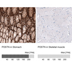 Anti-POSTN Antibody