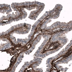 Immunohistochemical staining of human fallopian tube shows moderate to strong positivity in the extracellular matrix.