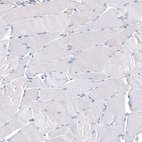 Immunohistochemical staining of human skeletal muscle shows no positivity in myocytes as expected.