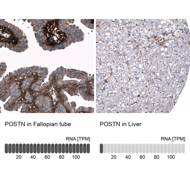Anti-POSTN Antibody
