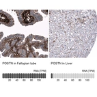 Anti-POSTN Antibody