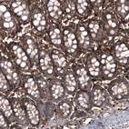 Immunohistochemical staining of human colon shows strong positivity in extracellular matrix, as well as modetrate positivity in glandular cells.