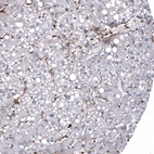 Immunohistochemical staining of human liver shows no positivity in hepatocytes as expected.