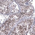 Anti-FOXM1 Antibody