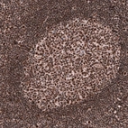 Immunohistochemical staining of human tonsil shows strong nuclear positivity in germinal center cells.