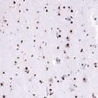 Immunohistochemical staining of human cerebral cortex shows moderate to strong nuclear positivity in neurons.