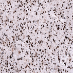 Anti-FOXM1 Antibody