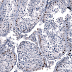 Immunohistochemical staining of human testis shows strong nuclear positivity in a subset of cells in seminiferous ducts.
