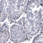 Immunohistochemical staining of human testis shows strong nuclear positivity in a subset of cells in seminiferous ducts.