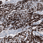 Anti-SALL4 Antibody