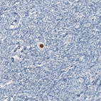 Anti-SALL4 Antibody