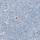 Immunohistochemical staining of human ovary shows strong nuclear positivity in oocyte.