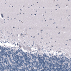 Immunohistochemical staining of human cerebellum shows no positivity in Purkinje cells as expected.