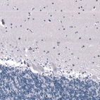 Immunohistochemical staining of human cerebellum shows no positivity in Purkinje cells as expected.