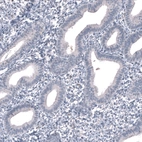 Immunohistochemical staining of human endometrium shows no positivity in glandular cells as expected.