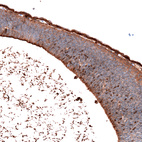 Anti-SALL4 Antibody