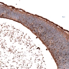 Immunohistochemical staining of mouse embryo E11 shows moderate to strong nuclear positivity in cells in developing hindbrain.