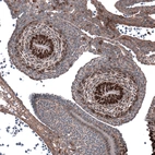 Immunohistochemical staining of mouse embryo E11 shows strong nuclear positivity in cells in developing testis.