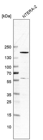 Western blot analysis in human cell line NTERA-2.