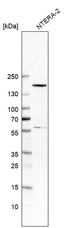 Western blot analysis in human cell line NTERA-2.