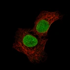 Immunofluorescence staining of NTERA-2 cells using the Anti-SALL4 monoclonal antibody, showing specific staining in the nucleoplasm and cytosol in green. Microtubule- and nuclear probes are visualized in red and blue, respectively (where available).
