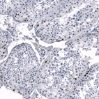 Immunohistochemical staining of human testis shows moderate to strong nuclear positivity in a subset of cells in seminiferous ducts.