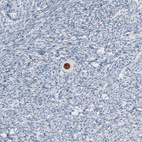 Immunohistochemical staining of human ovary shows strong nuclear positivity in oocyte.