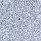 Immunohistochemical staining of human ovary shows strong nuclear positivity in oocyte.
