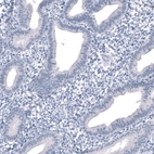 Immunohistochemical staining of human endometrium shows no positivity in glandular cells as expected.