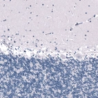 Immunohistochemical staining of human cerebellum shows no positivity in Purkinje cells as expected.