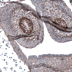 Immunohistochemical staining of mouse embryo E11 shows strong nuclear positivity in cells in developing testis.