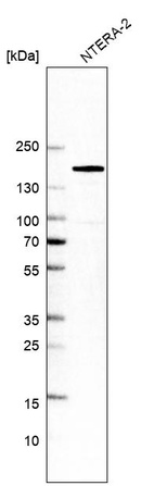 Western blot analysis in human cell line NTERA-2.