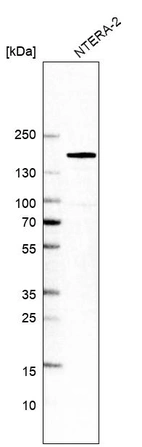 Western blot analysis in human cell line NTERA-2.
