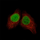 Immunofluorescence staining of NTERA-2 cells using the Anti-SALL4 monoclonal antibody, showing specific staining in the nucleoplasm and cytosol in green. Microtubule- and nuclear probes are visualized in red and blue, respectively (where available).