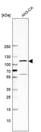 Anti-GLI1 Antibody