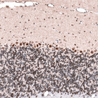 Anti-GLI1 Antibody