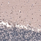 Immunohistochemical staining of human cerebellum shows nucleolar positivity in Purkinje cells, as well as nuclear positivity in a subset of neurons in the molecular layer.