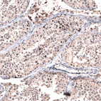 Anti-GLI1 Antibody