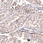Immunohistochemical staining of human testis shows strong nuclear positivity in a subset of cells in seminiferous ducts.