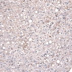Immunohistochemical staining of human liver shows no nuclear positivity in hepatocytes as expected.