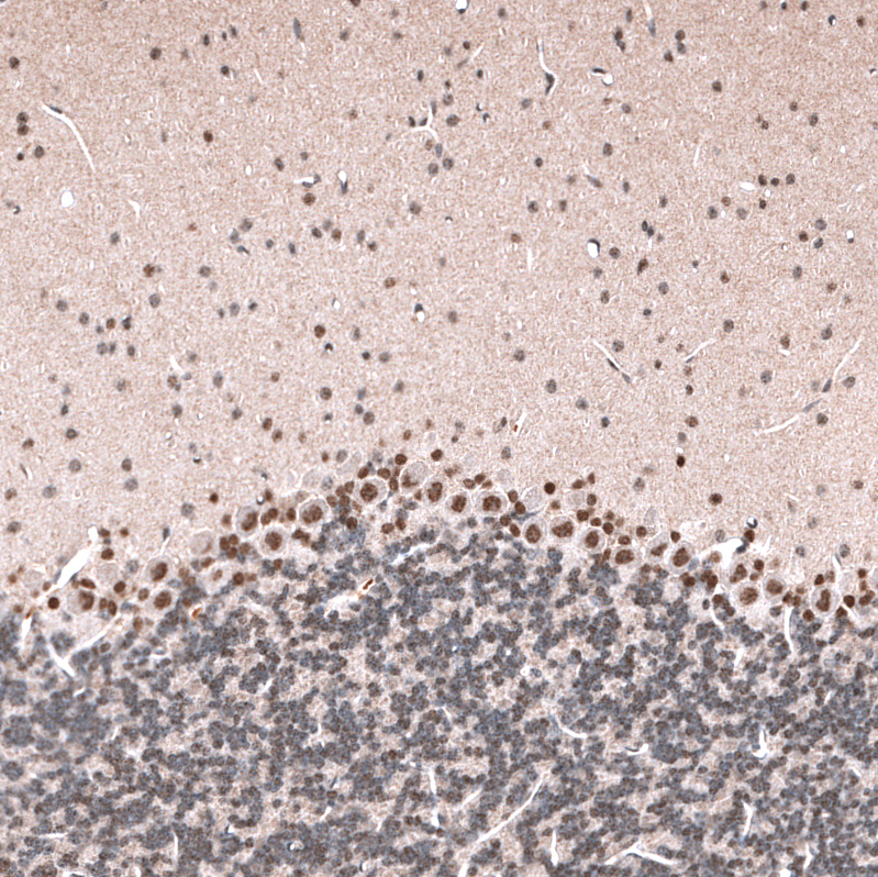 Anti-GLI1 Antibody