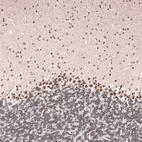 Anti-GLI1 Antibody